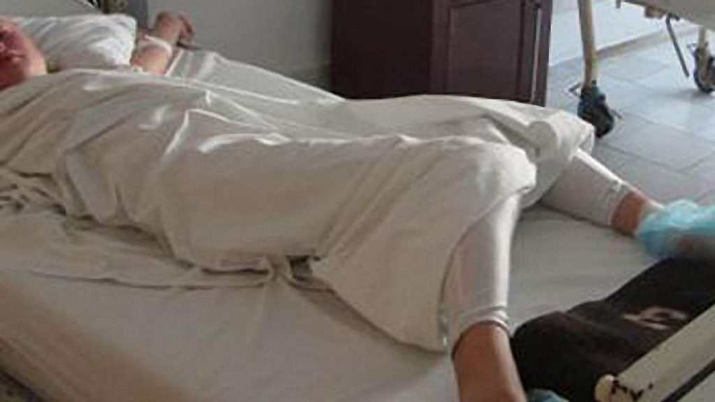 На Прикарпатті ледь не загинув 83-річний пенсіонер, який спалював відходи на своїй присадибній ділянці