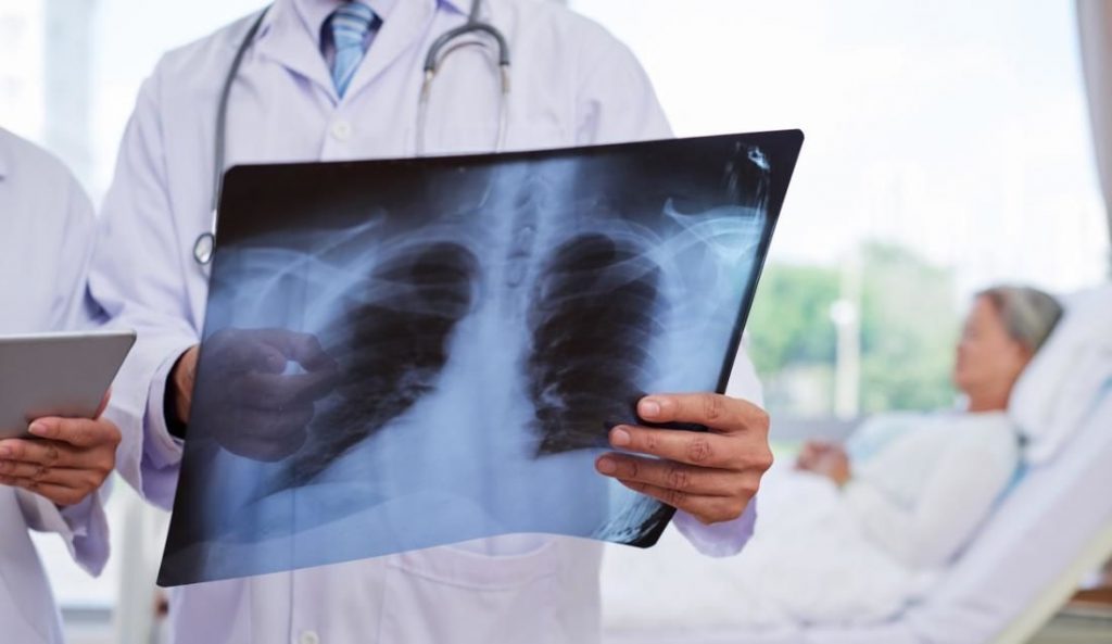 Марцінків: у Івано-Франківську немає спалаху пневмоній