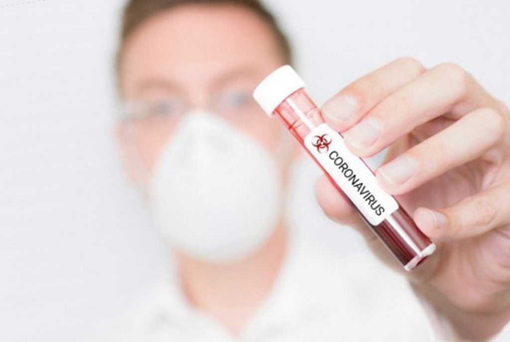 За минулу добу на Прикарпатті підтверджено три нових випадки захворювання на коронавірус