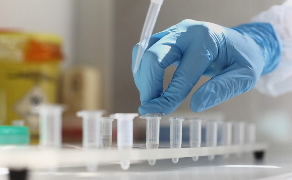 На Прикарпатті офіційно зареєстровано вже 16 випадків інфікування китайським вірусом - з них два випадки летальні