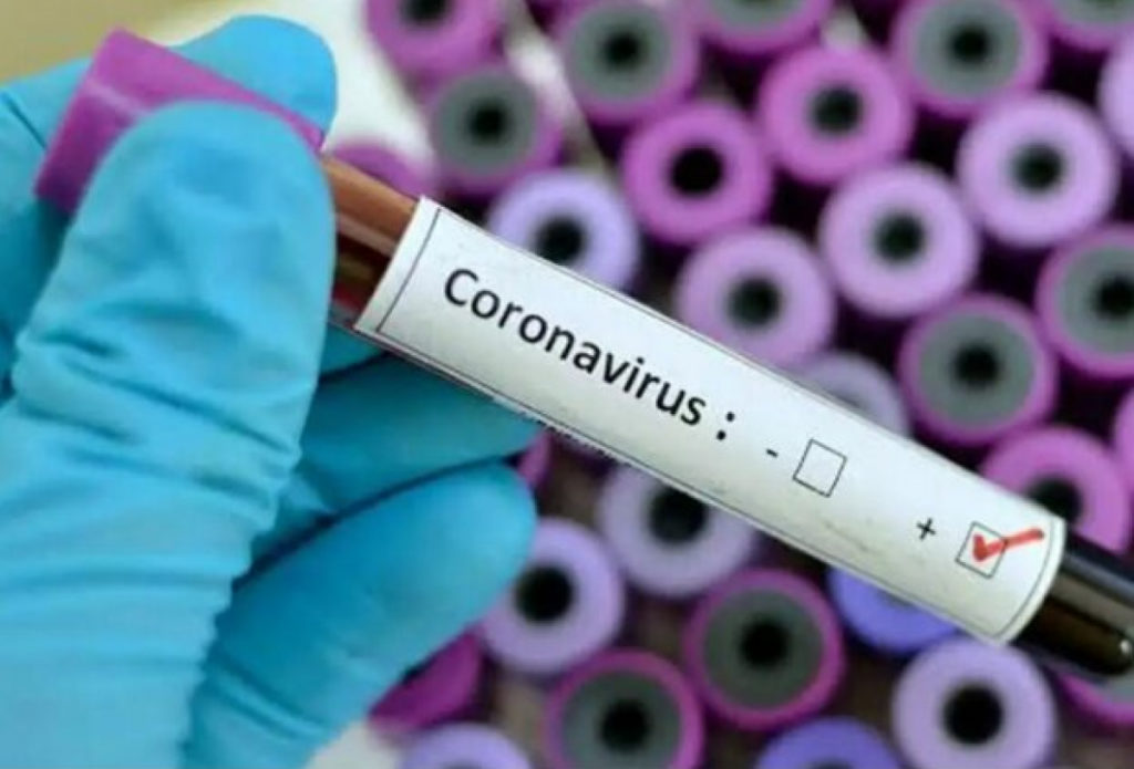 На Прикарпатті вже зафіксовано 218 випадків інфікування коронавірусом