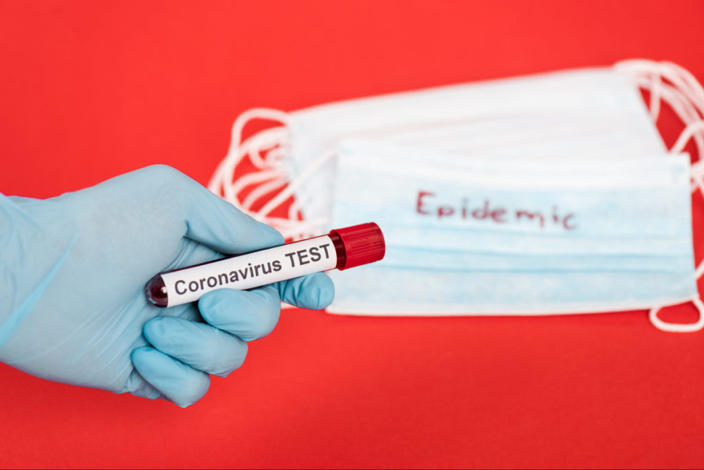 Через високу смертність від коронавірусу на Прикарпаття направили урядову перевірку