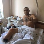 Франківець Артур Хлопек, який підірвався на міні на Донбасі потребує допомоги