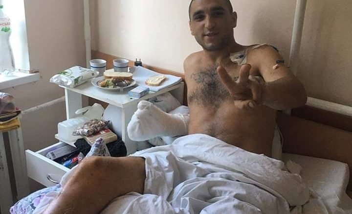 Атовцю з Франківська, який втратив ногу, місто виділило допомогу