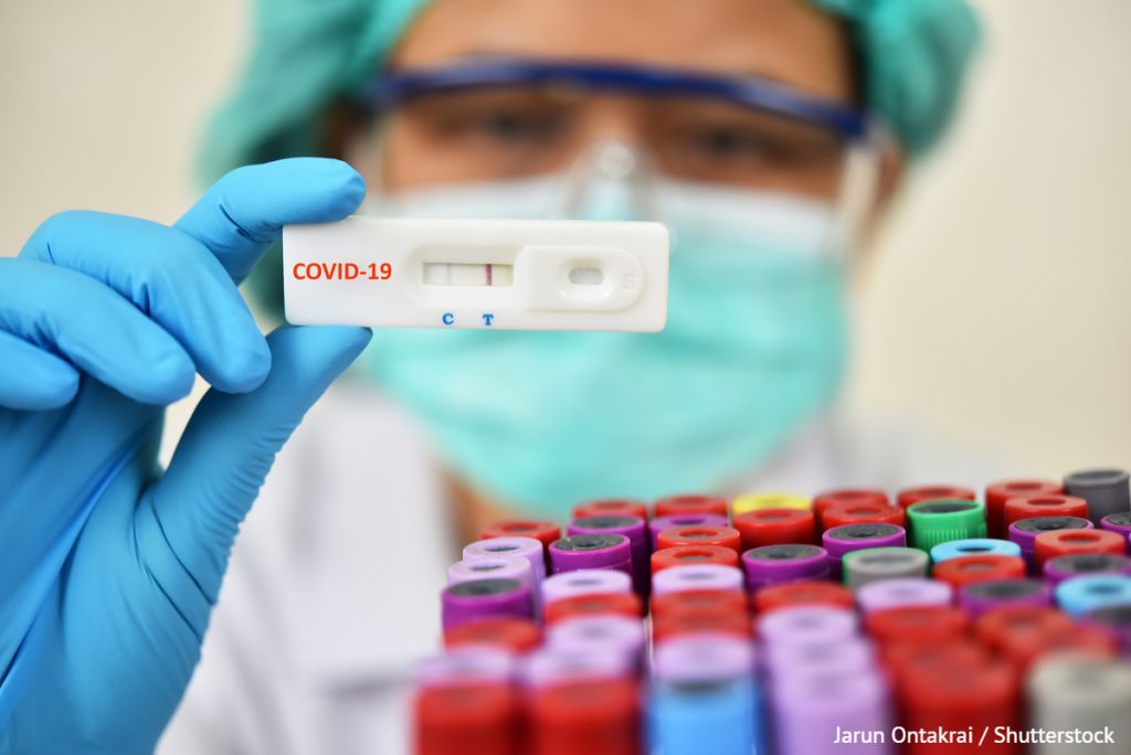 На Прикарпатті зафіксували 124 нових випадків захворювання на COVID-19