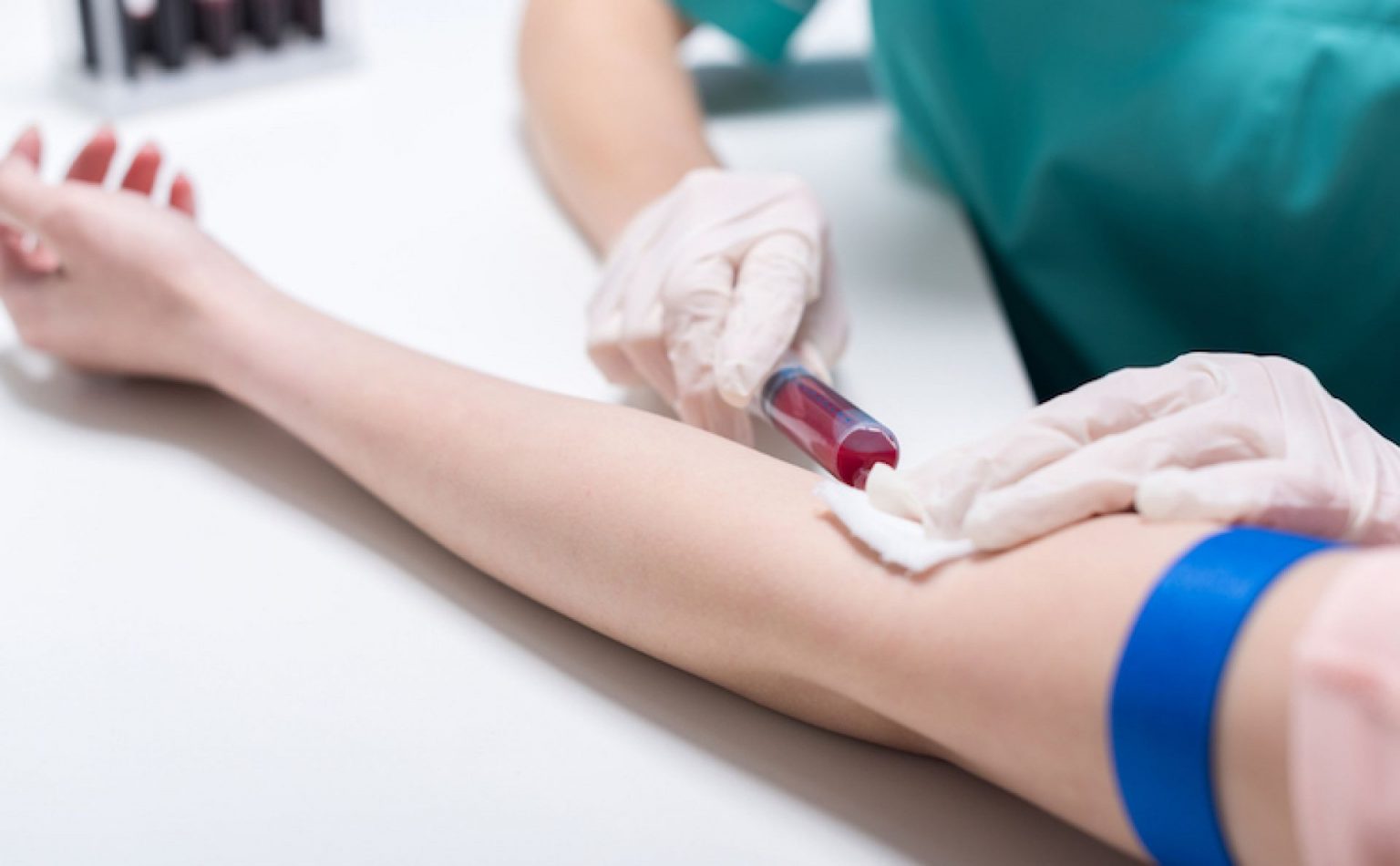 Прикарпатці зможуть безкоштовно здати тести на ВІЛ та гепатити