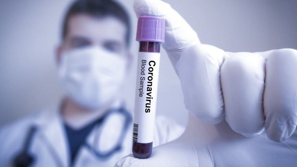 На Прикарпатті 428 нових хворих на COVID-19