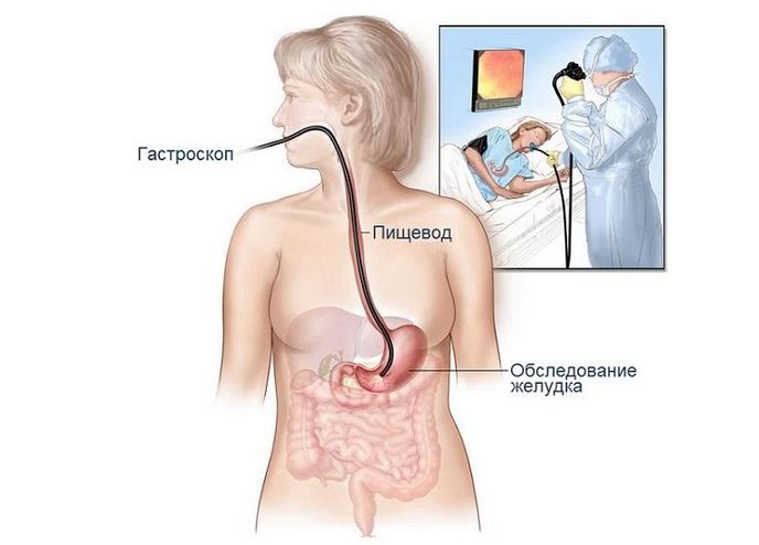 Гастроскопия: суть исследования, особенности проведения