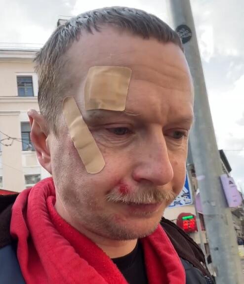 Словесний конфлікт переріс у бійку: у столиці побили відомого прикарпатського журналіста ВІДЕО