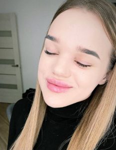 Скандальна Франківська блогерка зробила собі контурну пластику і стала почуватися щасливішою ФОТО
