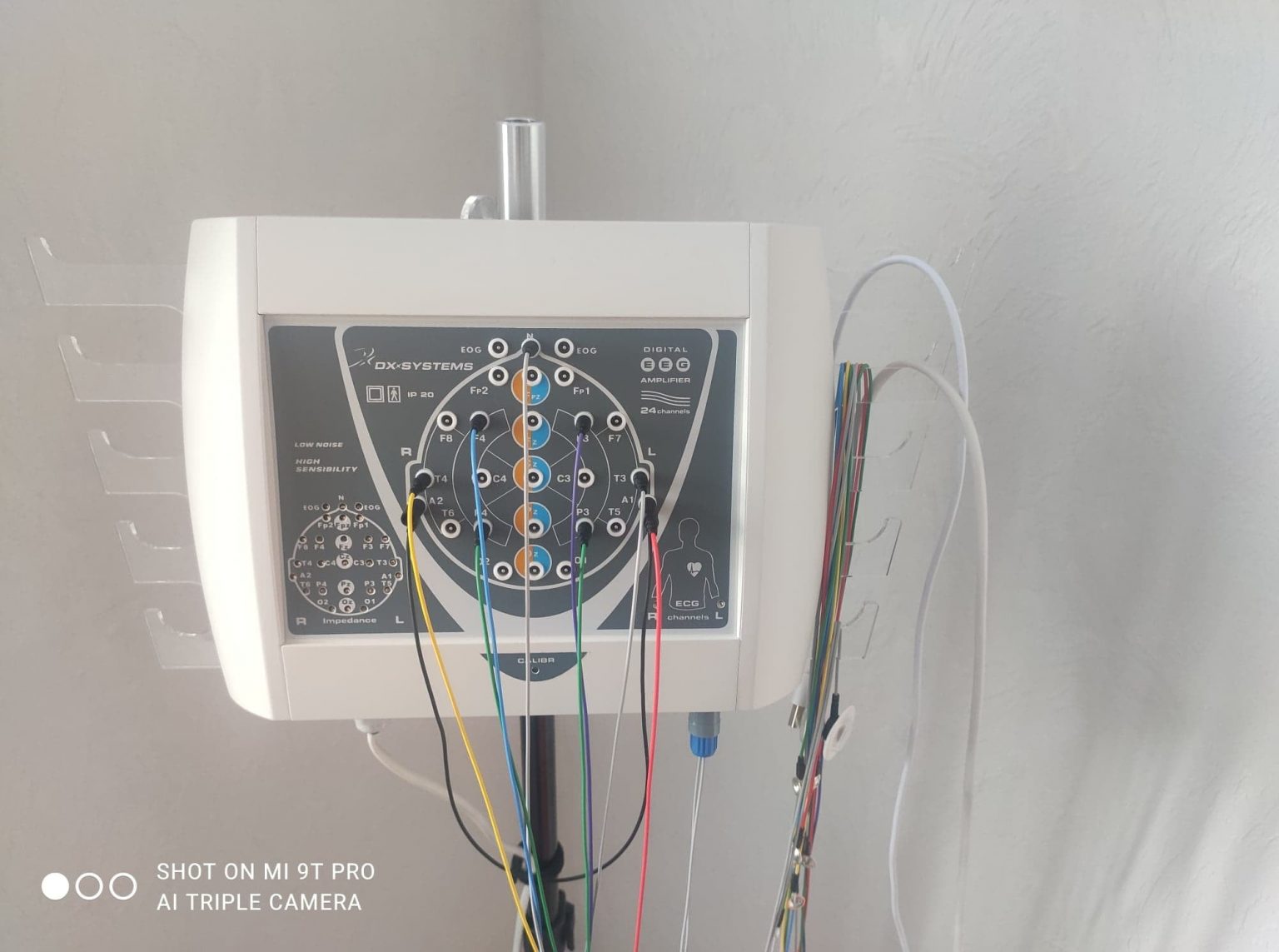 Франківський обласний пологовий купив нове обладнання для виходжування новонароджених