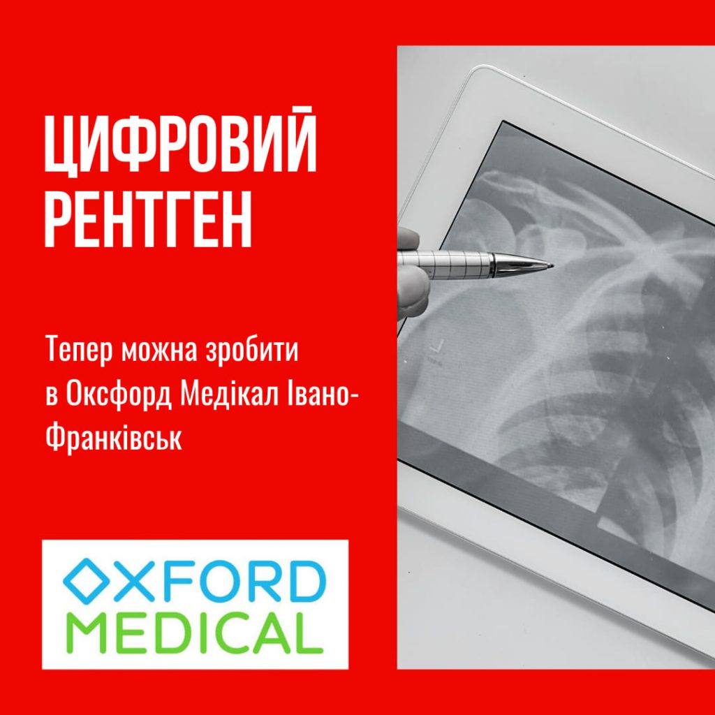 У франківській клініці "Оксфорд Медікал" запрацював рентген апарат останнього покоління