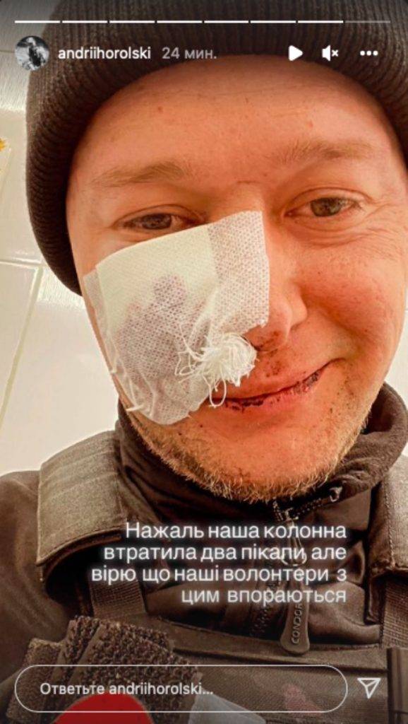 Лідер гурту "Бумбокс" потрапив під обстріл та отримав поранення ФОТО