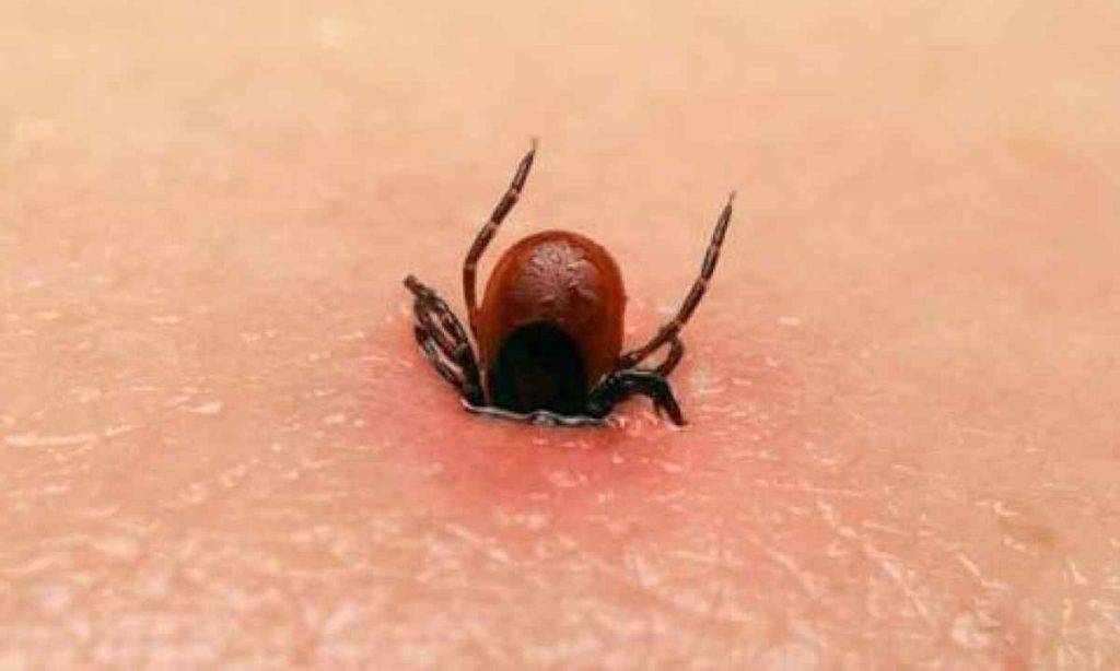 Чим небезпечний укус кліща? Консультує інфекціоніст!