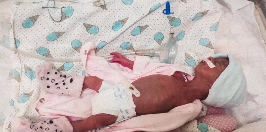 Прикарпатські медики виходили “поспішайку”, яка народилась з вагою 775 грам