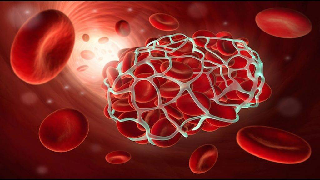 Скрининг тромбофилии