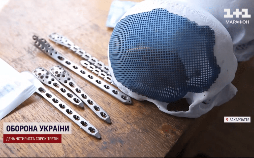 На Закарпатті виробляють пластини, які рятують кінцівки та зовнішність військових