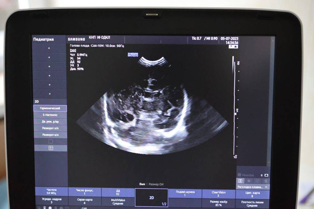 благодійний фонд КОЛО,В Обласну дитячу лікарню передали УЗД-апарат,УЗД-апарат для цілодобового нагляду за поспішайками