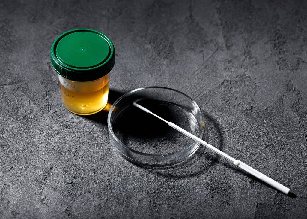 Как лечить неспецифический уретрит?