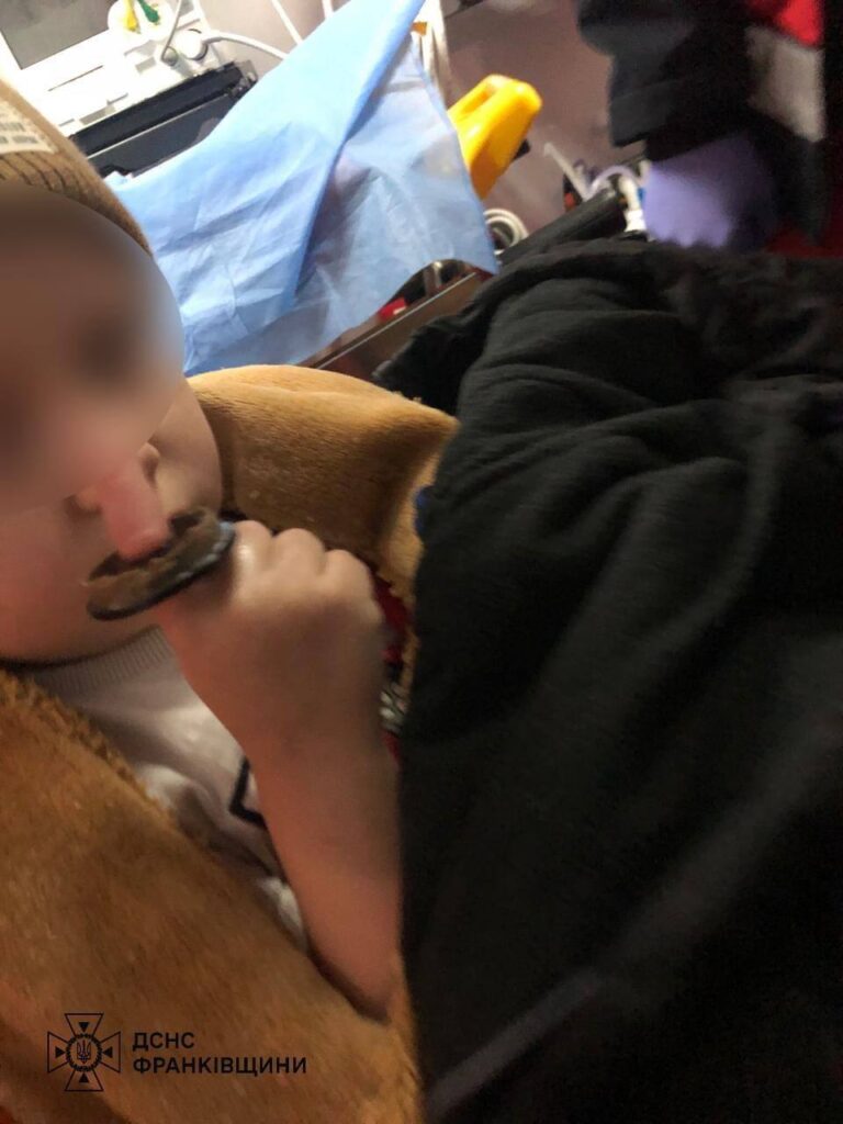 У Франківську рятувальники визволяли палець дитини з іграшки. ФОТО