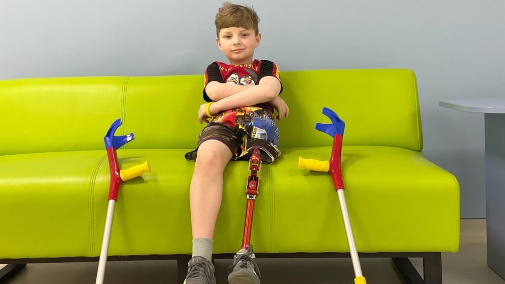 Дев'ятирічному прикарпатцю, який втратив ногу через рак, встановили протез