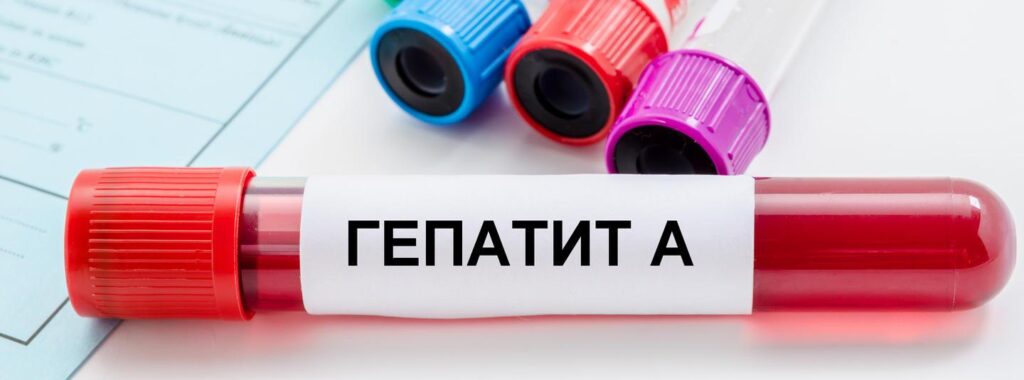 У селі на Калущині зафіксували сімейний спалах гепатиту А