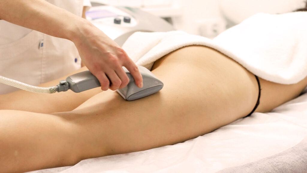 Де можна пройти процедуру сучасного вакуумно-роликового масажу в Івано-Франківську