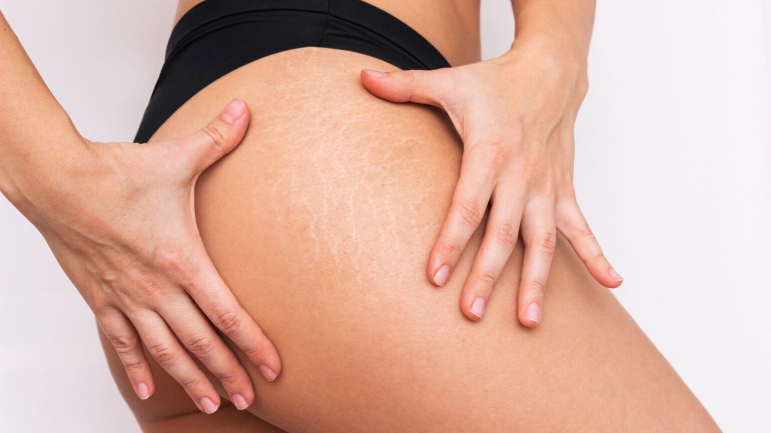 Як позбутися рубців та розтяжок: ефективні методи відновлення шкіри у франківській клініці Fineline.ua