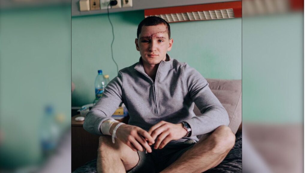 У Франківську провели реконструктивну операцію пораненому військовому. ФОТО