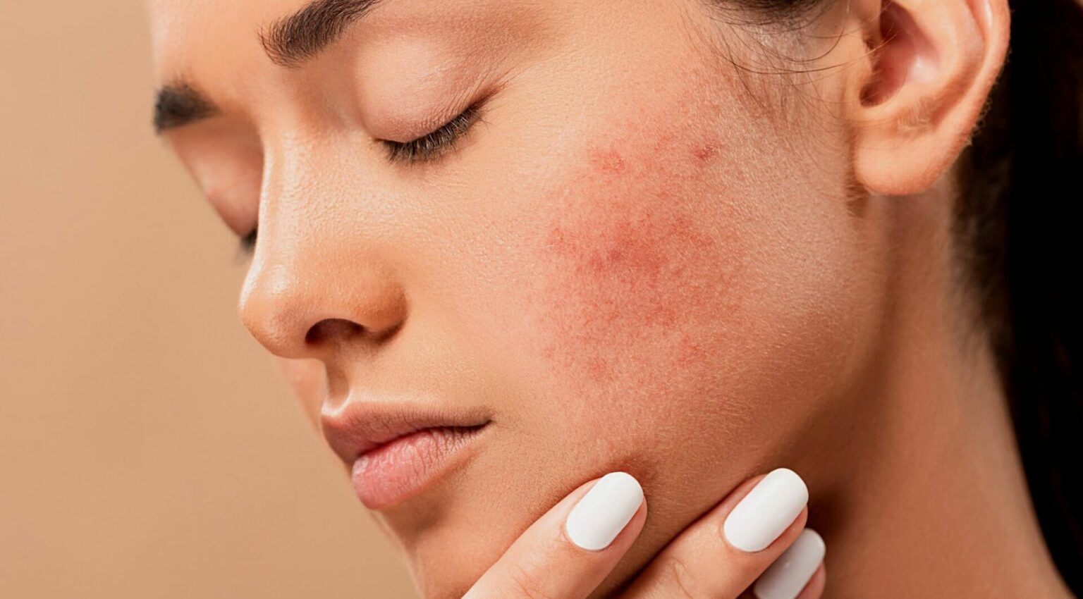 Коли школа стає випробуванням: акне, булінг і сучасні рішення для підліткової шкіри