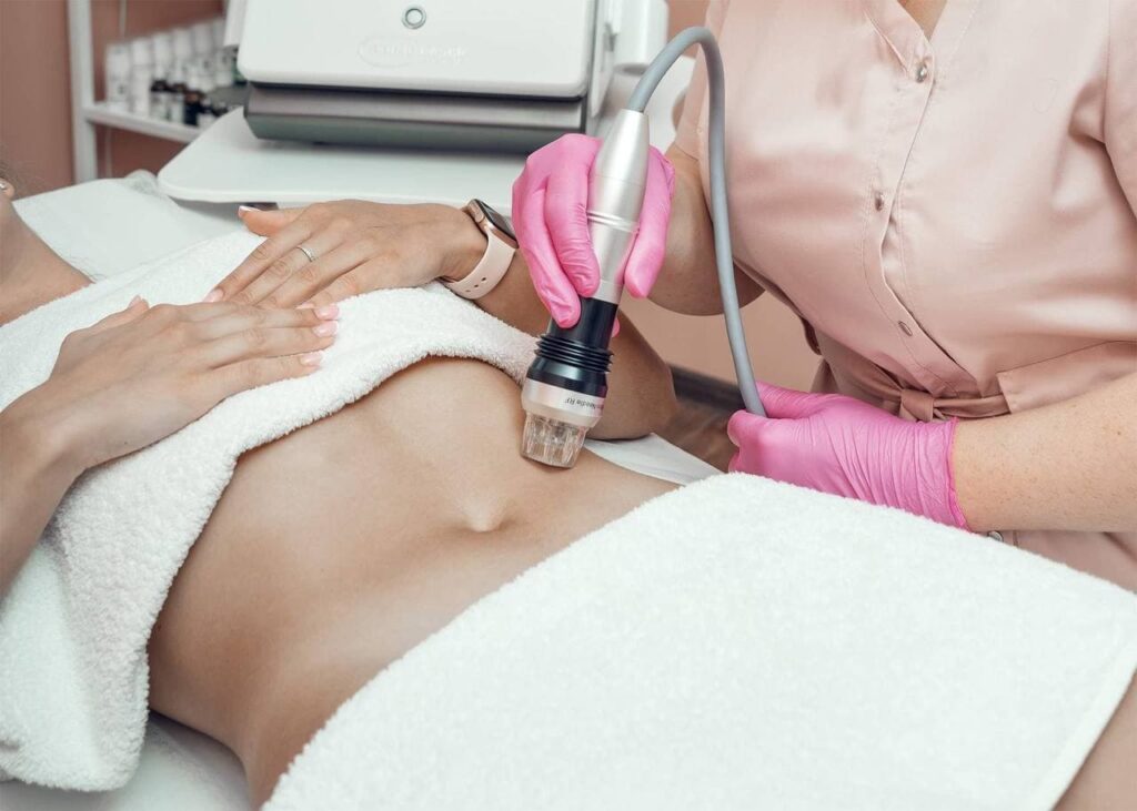 Осінній бум у косметології: чому лазерне шліфування та мікроголковий RF стали сенсацією сезону