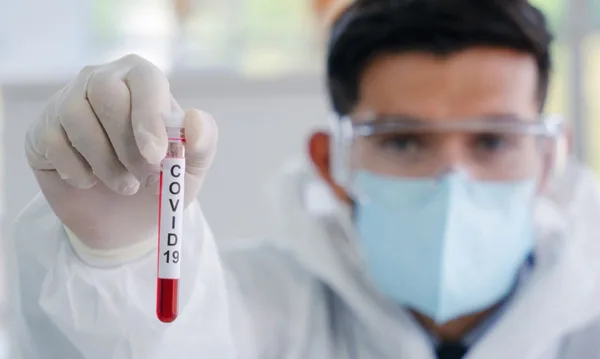 Медик тримає пробірку з тестом на COVID-19