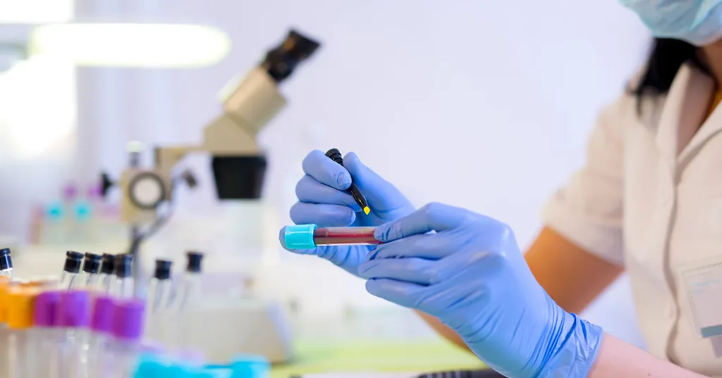 Лаборант аналізує пробірку з кров'ю
