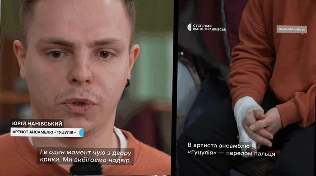 Артист ансамблю Гуцулія з травмованою рукою