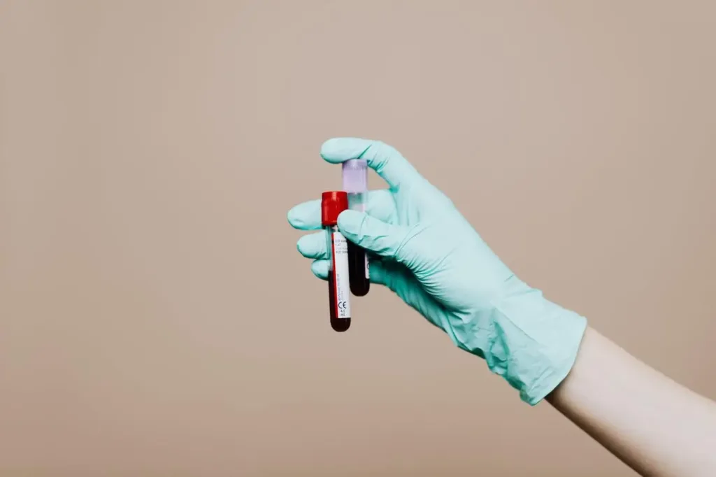 Медик тримає пробірку зразка крові