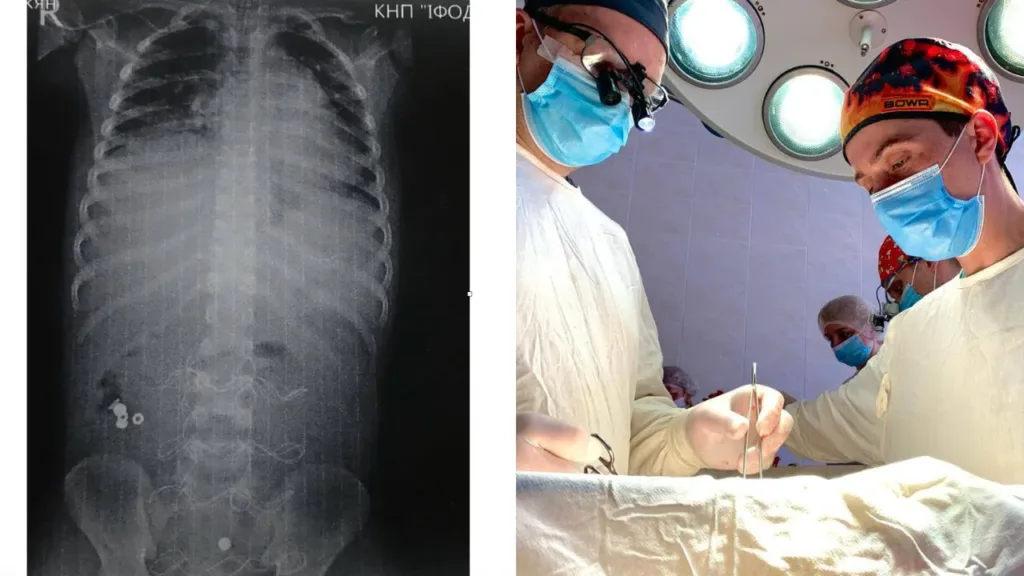 Рентген і хірурги під час операції