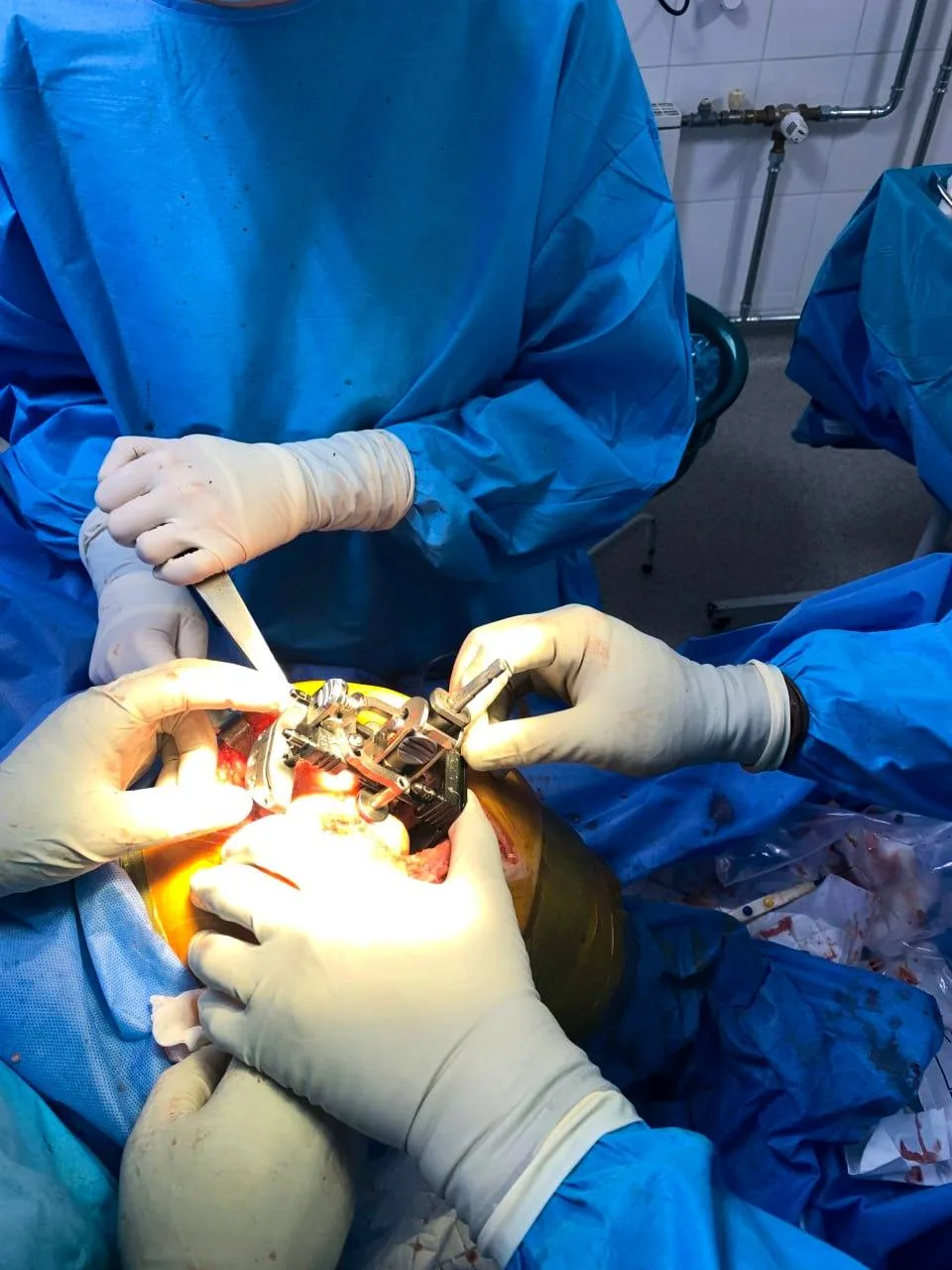 Хірурги проводять операцію на колінному суглобі