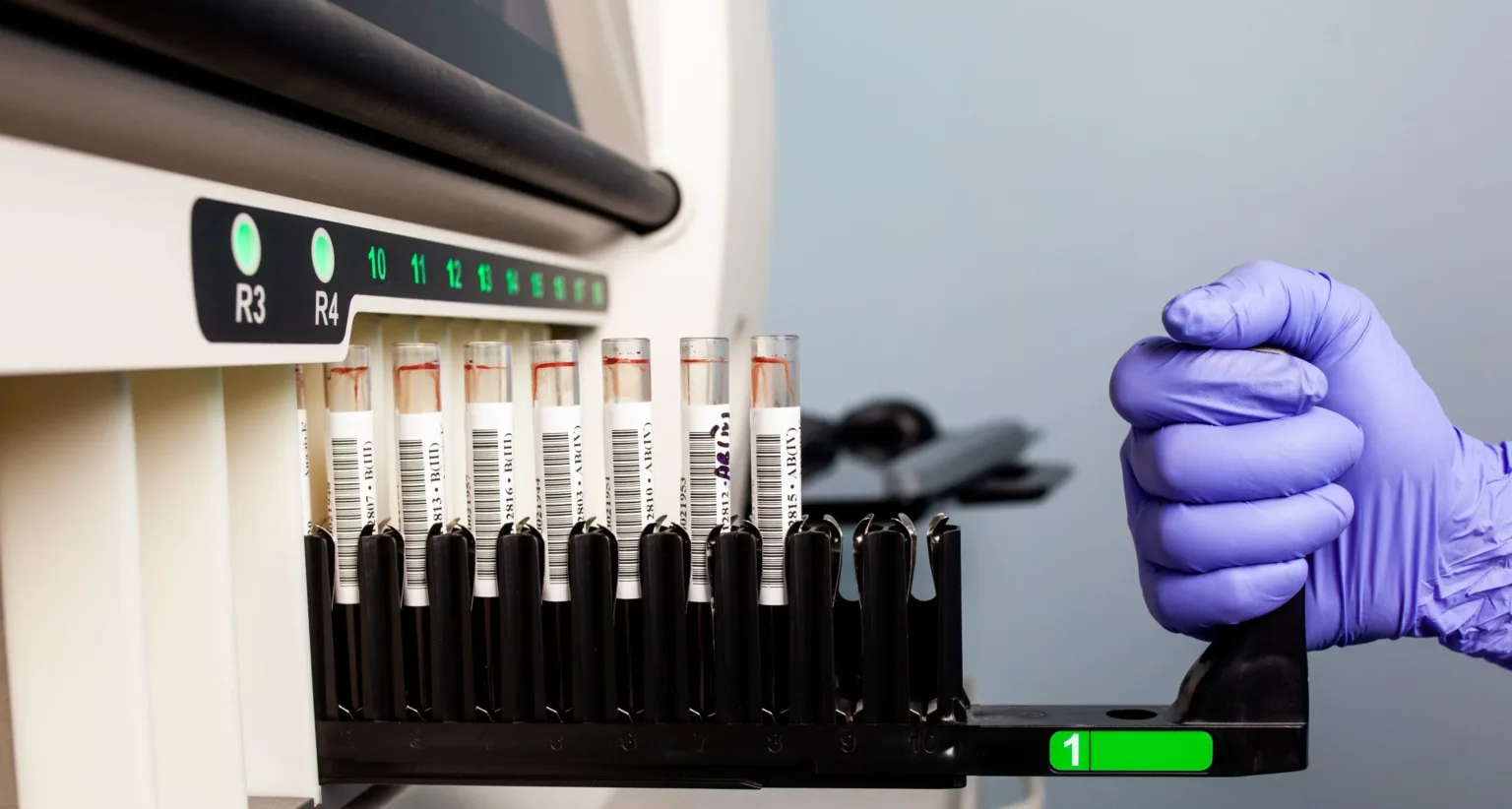 Пробірки з кров'ю в лабораторному аналізаторі