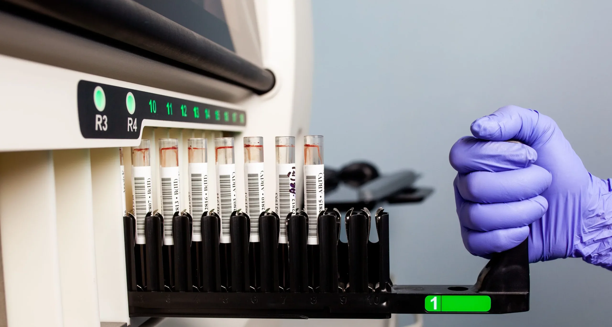 Пробірки з кров'ю в лабораторному аналізаторі