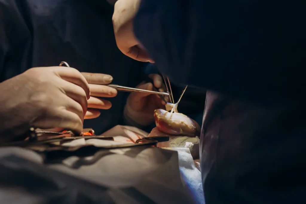 Хірурги виконують операцію з трансплантації органу