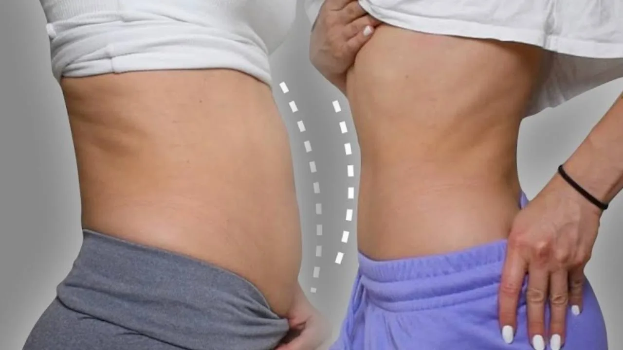 До і після схуднення живота
