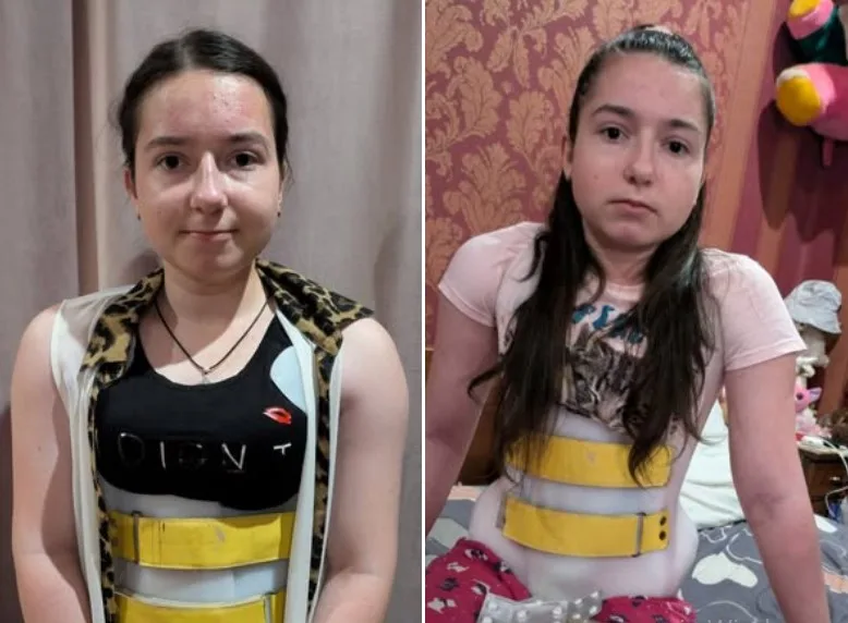 Дві дівчини у медичних ортопедичних корсетах вдома